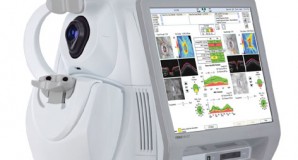 Tomografía ocular computerizada (OCT)